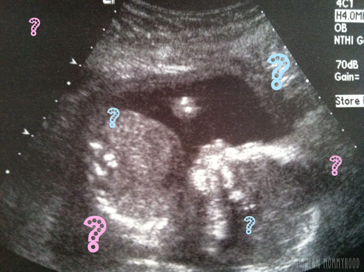 is it a boy or girl: week 17 18 ultrasound